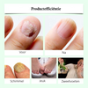 NailDrops 2+1 GRATIS: Vloeibare Nagelschimmelherst Reparatieellende Druppels