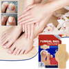 NailPatch 1+1 GRATIS - Schimmelwerend, Antibacterieel Nagelverzorging Patch Pak