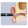 EarCleaning - HD Oorcamera Wax Reinigingsset